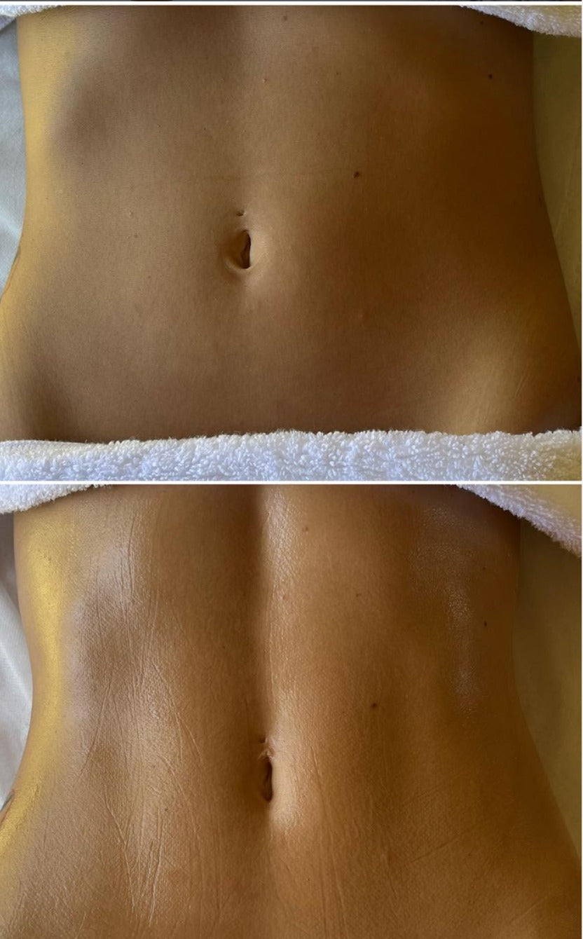ABDOMEN ANTI BLOATING DETOX MASSAGE