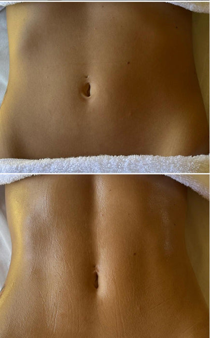 ABDOMEN ANTI BLOATING  DETOX MASSAGE