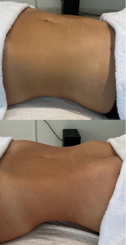 BRAZILIAN BODY SCULPT MASSAGE | FOR TWO